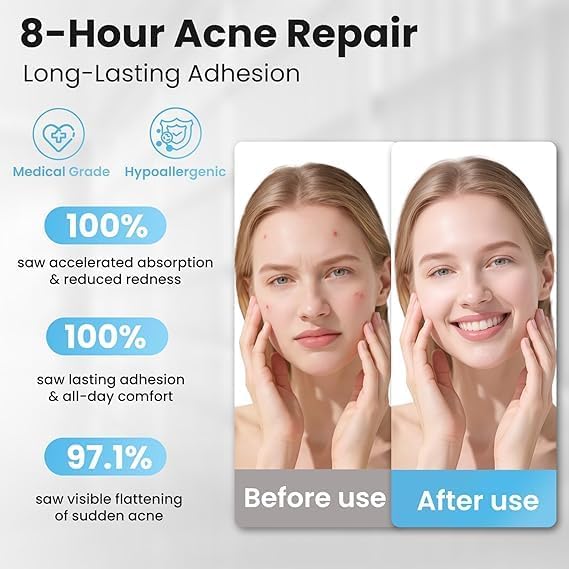 Hydrocolloid Pimple Patch Roll (10 FT / 200+ Cuts) – Invisible Matte Overnight Acne Zit Absorbing Bandage for Face & Body
