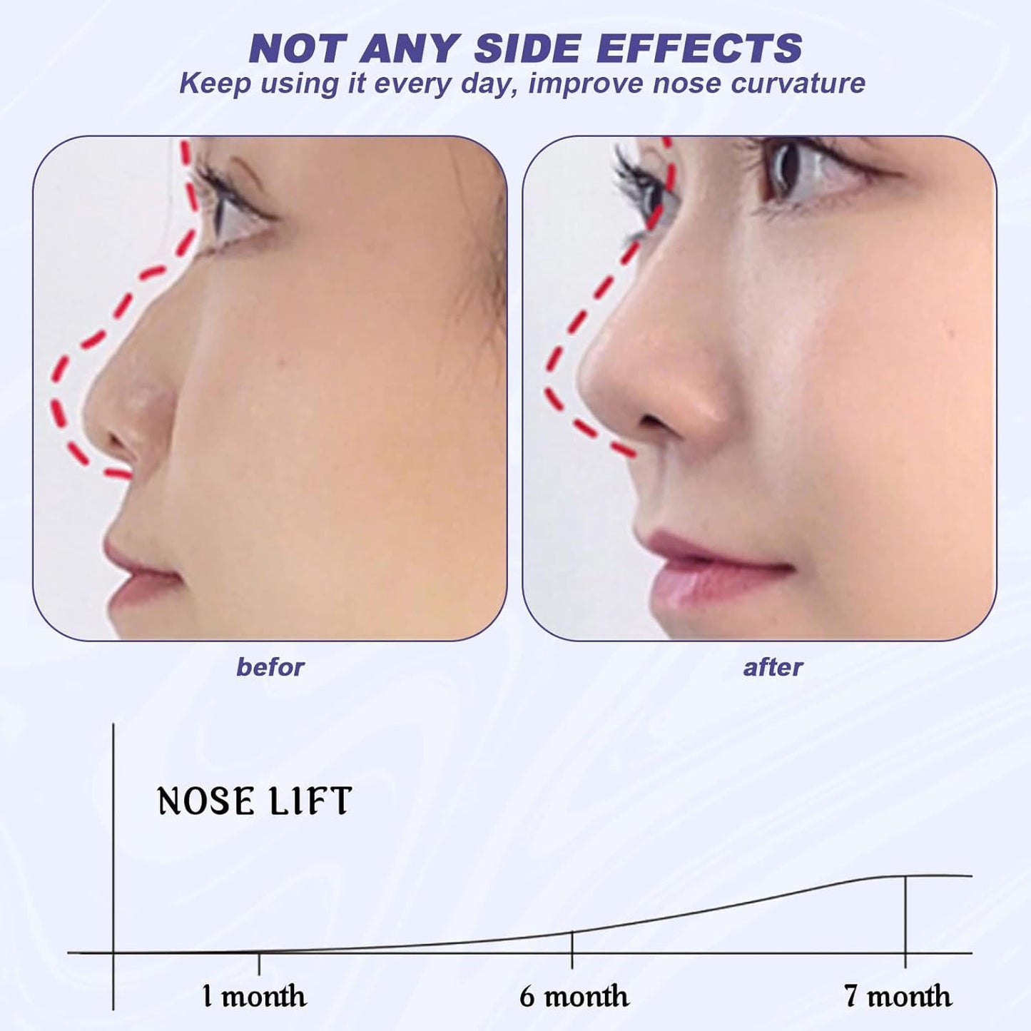 DropShelf 3D Silicone Nose Shaper Clip  | Non-Surgical Contour & Lifter