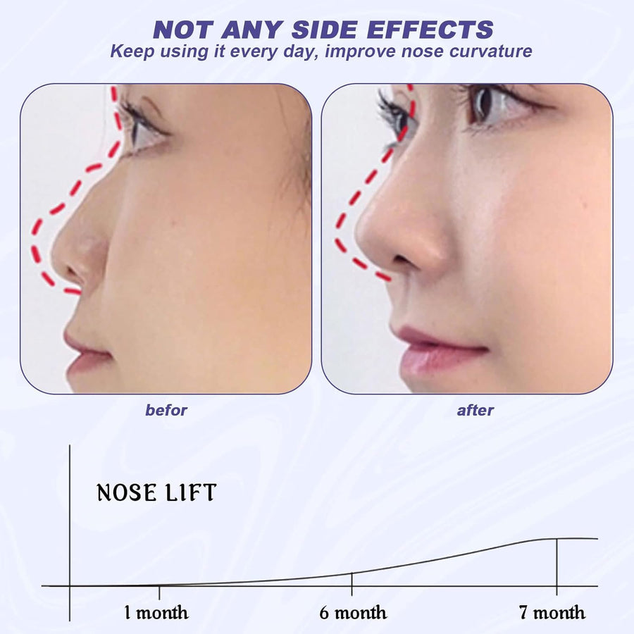 DropShelf 3D Silicone Nose Shaper Clip  | Non-Surgical Contour & Lifter