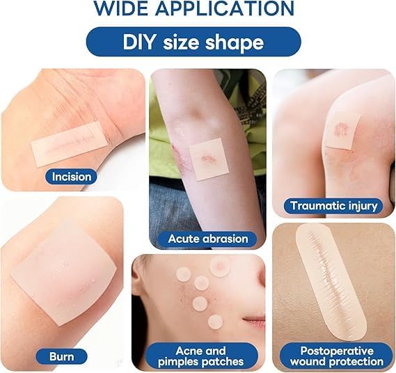 Hydrocolloid Pimple Patch Roll (10 FT / 200+ Cuts) – Invisible Matte Overnight Acne Zit Absorbing Bandage for Face & Body
